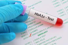 HbA1c Glycated Hemoglobin